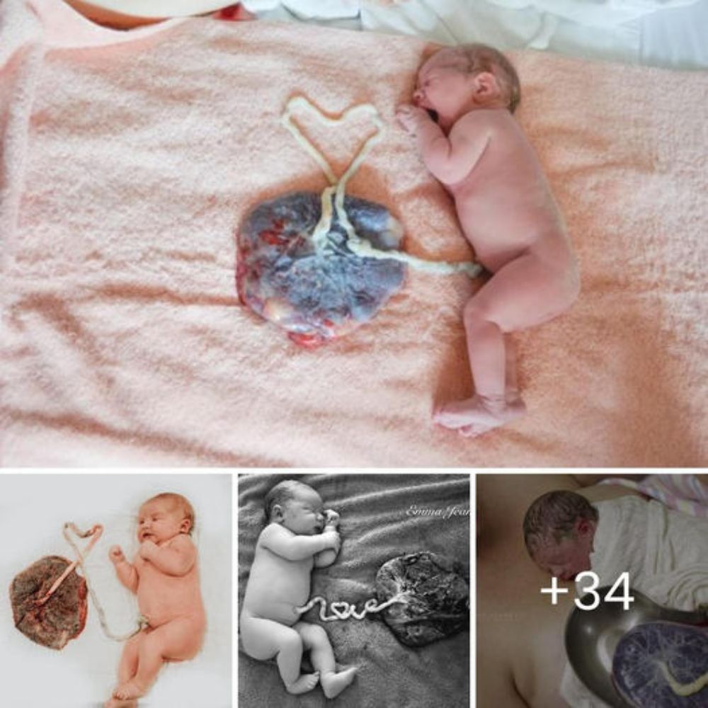 Newborn Harper Forms the Word ‘LOVE’ with Her Umbilical Cord, Celebrating Maori Tradition and Cultural һeгіtаɡe